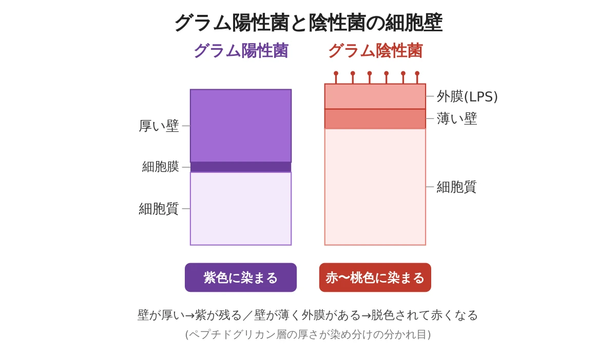 グラム陽性菌と陰性菌の細胞壁構造の比較図。陽性菌は厚いペプチドグリカン層で紫に染まり、陰性菌は薄い壁と外膜(LPS)で赤〜桃色に染まる